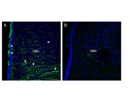 Anti-Semaphorin 4A (SEMA4A) (extracellular) Antibody