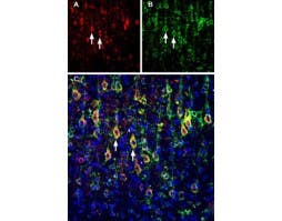 Anti-Slitrk1 (extracellular) Antibody