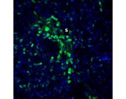 Anti-Slitrk2 (extracellular) Antibody