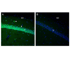 Anti-GPR91 (SUCNR1) (extracellular) Antibody