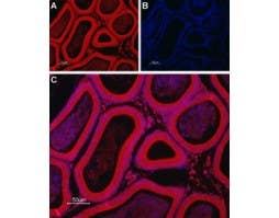 Anti-TRIC-B (TMEM38B) Antibody