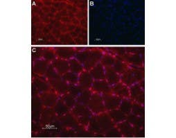 Anti-TRIC-A (TMEM38A) Antibody