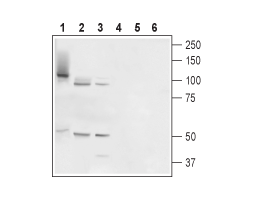 Anti-TMC6 (EVER1) Antibody