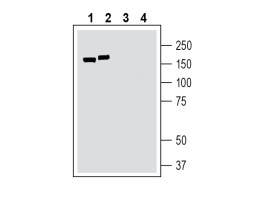Anti-TMC1 (extracellular) Antibody