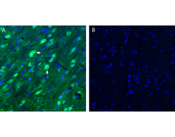 Anti-Neurokinin 2 Receptor (NK2R) Antibody
