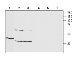 Anti-TRHR1 Antibody