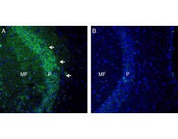 Anti-TSH Receptor (TSHR) (extracellular) Antibody
