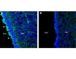 Anti-Taste Receptor Type 1 Member 3 (TAS1R3) (extracellular) Antibody