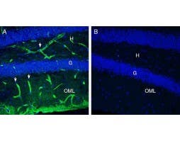 Anti-MERTK (extracellular) Antibody