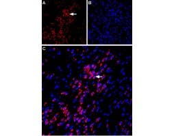 Anti-VPAC1 (VIPR1) (extracellular) Antibody