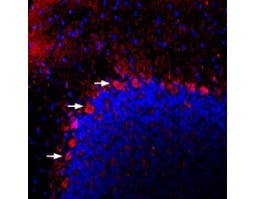 Anti-PACAP Receptor 1 (PAC1) Antibody