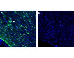 Anti-Vasopressin V<sub>1A</sub> Receptor (AVPR1A) Antibody