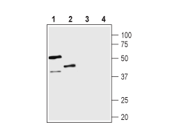 Anti-Vasopressin V<sub>1B</sub> Receptor (AVPR1B) Antibody