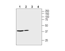 Anti-Vasopressin V<sub>2</sub> Receptor (AVPR2) Antibody