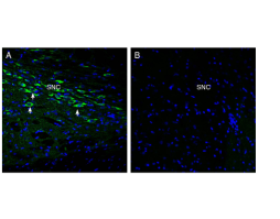 Anti-Oxytocin Receptor Antibody