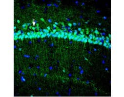 Anti-ZIP3 (SLC39A3) Antibody
