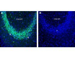 Anti-ZIP10/SLC39A10 (extracellular) Antibody