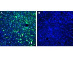 Anti-ZnT4 (SLC30A4) Antibody
