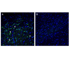 Anti-ZnT10 (SLC30A10) Antibody