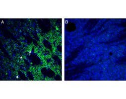Anti-ZIP14 (SLC39A14) Antibody