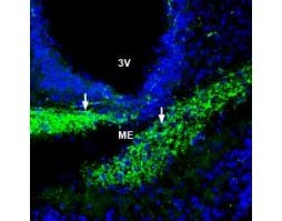 Anti-ZIP6/SLC39A6 (extracellular) Antibody