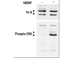 Recombinant human BDNF protein
