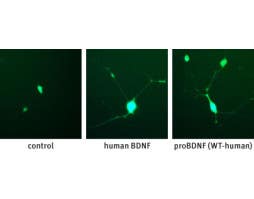 Recombinant human proBDNF protein