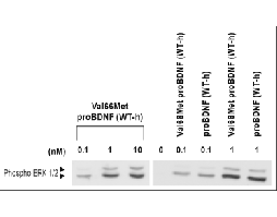 Recombinant human Val66Met proBDNF protein