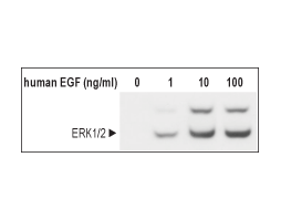 Recombinant human EGF protein