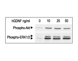Recombinant human GDNF protein