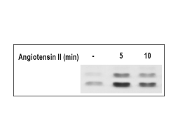 Angiotensin II