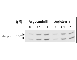 Angiotensin III