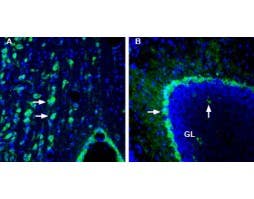 Anti-CRTH2/GPR44 (extracellular) Antibody