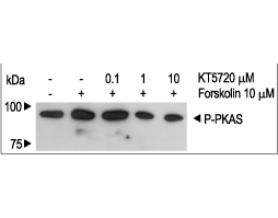 KT5720