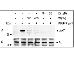 LY 294002