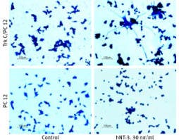 Recombinant human Neurotrophin-3 (NT-3) protein