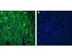 Rabbit IgG Isotype Control
