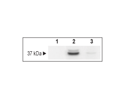 Human TrkB-Fc Chimera