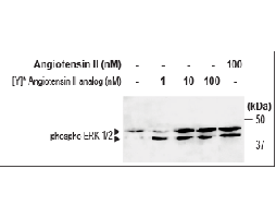 [Y]6-Angiotensin II Analog