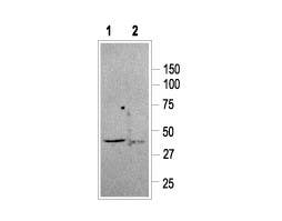 Anti-Somatostatin Receptor Type 2 Antibody