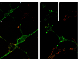 Stichodactyla Toxin-ATTO Fluor-590