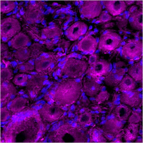 α-Dendrotoxin-ATTO Fluor-647N