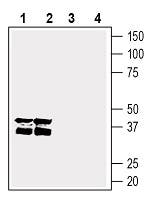 GPR55 (extracellular) Blocking Peptide