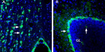 Anti-CRTH2/GPR44 (extracellular) Antibody