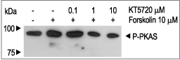 KT5720