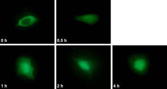 Leptomycin B