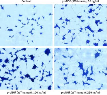 Recombinant human proNGF protein