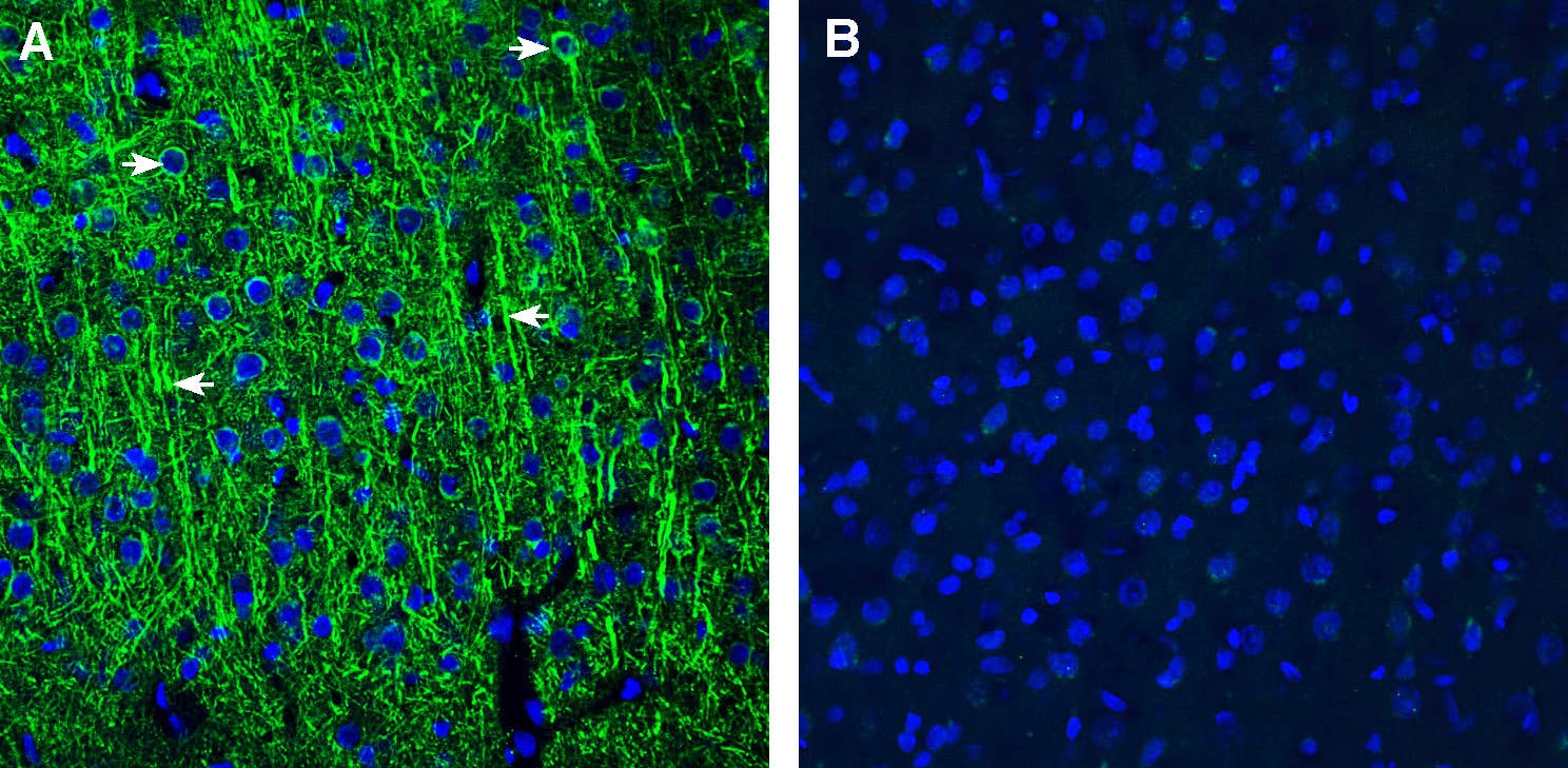 Rabbit IgG Isotype Control
