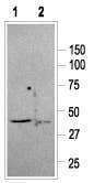 Anti-Somatostatin Receptor Type 2 Antibody - Carrier Free