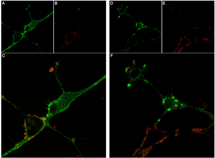 Stichodactyla Toxin-ATTO Fluor-590